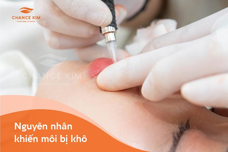 Phun môi xong bị khô phải làm sao? 4 cách giúp bạn