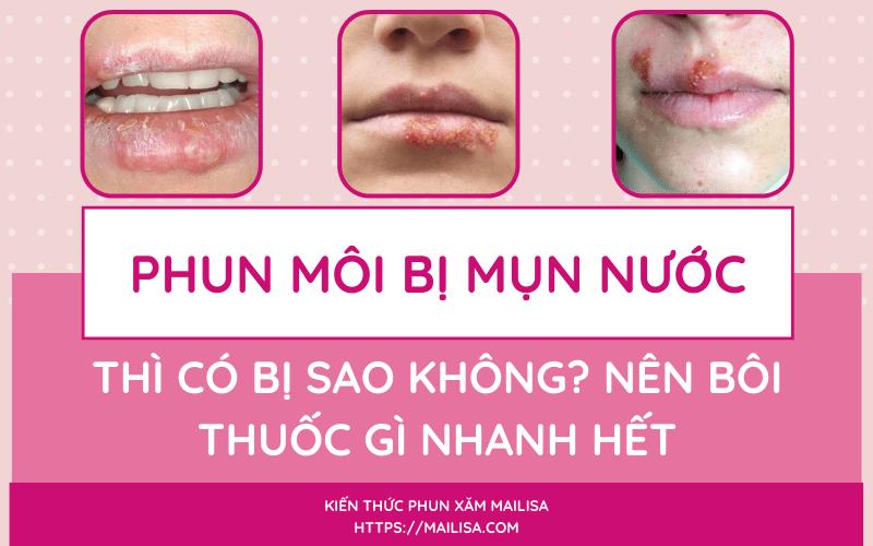 Mụn nước ở môi sau khi phun xăm có nguy hiểm không? Nên uống thuốc gì?