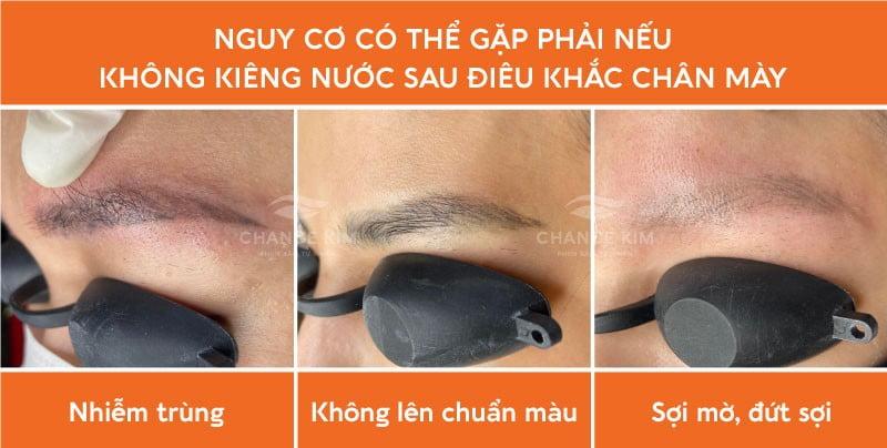 3 rủi ro thường gặp nếu không kiêng nước sau điêu khắc chân mày