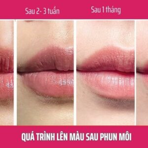 Quá trình lên màu sau phun môi diễn ra như thế nào? Cần lưu ý những gì?