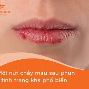 Phun môi xong bị nứt chảy máu có bị làm sao không?