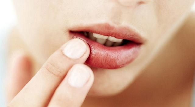 Phun môi bị sưng bình thường sẽ khỏi sau 3-5 ngày
