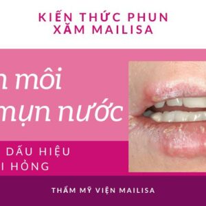 Mụn nước ở môi sau khi phun xăm: Nguy hiểm và cách điều trị