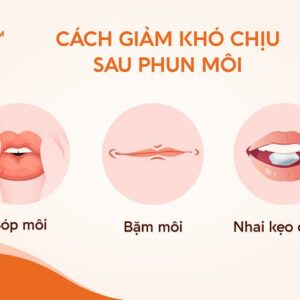 Phương pháp giảm sưng môi sau phun: Chườm đá làm giảm sưng hiệu quả