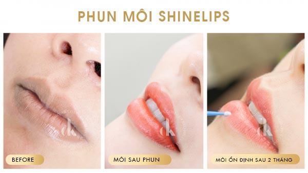 Phun môi không đều màu, nguyên nhân và cách khắc phục